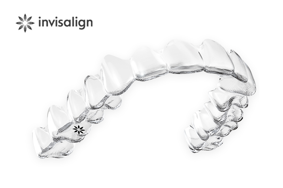 マウスピース矯正