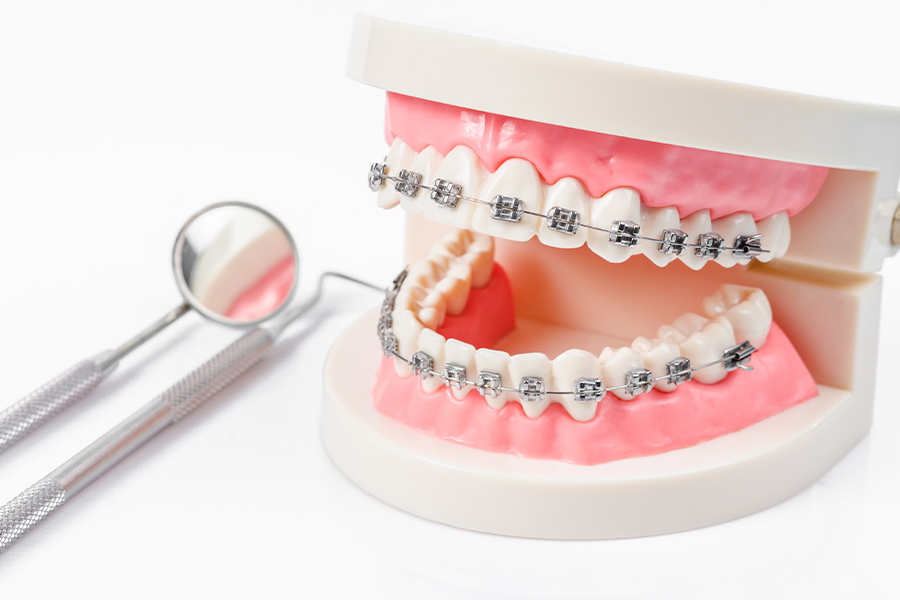 矯正歯科について