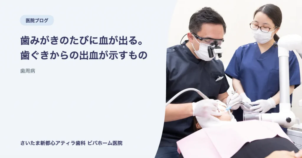 歯みがきのたびに血が出る。歯ぐきからの出血が示すもの|さいたま新都心アティラ歯科 ビバホーム医院のブログ記事アイキャッチ